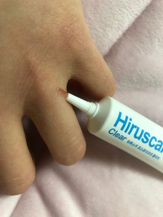 히루스카 포스트아크네 클리어 — 4점을 준 리뷰어가 2021년 3월 올린 사용 사진