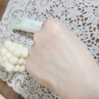 건선/아토/습진/민감성 피부 천연보습진정크림 소리온 크림 & 센시티브 크림 50g — 5점을 준 리뷰어가 2022년 1월 올린 사용 사진