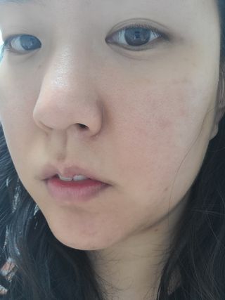 셀바이져 지우개 미스트 피부 보호 입주변 트러블 진정 케어 아기 안개분사 미스트 — 5점을 준 리뷰어가 2021년 3월 올린 사용 사진
