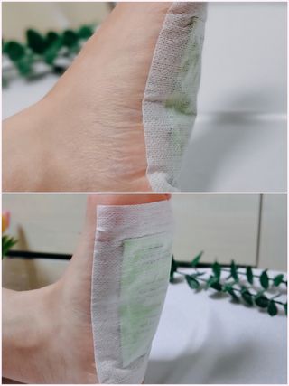 [레제르] 아로마 수액패치 발패치 30매입 -라벤더향/유칼립투스향/대나무향 — 5점을 준 리뷰어가 2022년 4월 올린 사용 사진
