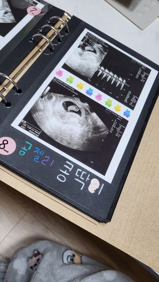 콩딱맘👶🏻님이 올린 리뷰 사진 3