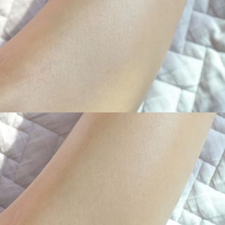 유이크 바이옴 레미디 바디 로션 — 5점을 준 리뷰어가 2022년 11월 올린 사용 사진