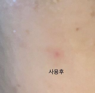 체르엠 그린 케비어 더블워터 마스크팩 5매입  2팩 — 5점을 준 리뷰어가 2021년 11월 올린 사용 사진