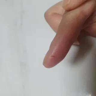 [큐어반H 커팅] 간편하게 떼서 쓰는 자외선차단 습윤밴드 (1팩/30매입) — 3점을 준 리뷰어가 2022년 11월 올린 사용 사진