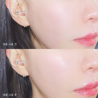 리더스코스메틱 리더스 카밍 바이오틱스 퀵 수딩 패드 — 5점을 준 리뷰어가 2022년 5월 올린 사용 사진