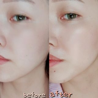 바이오오일 [바이오-오일] 스킨케어 오일 내추럴 60ml — 4점을 준 리뷰어가 2021년 6월 올린 사용 사진
