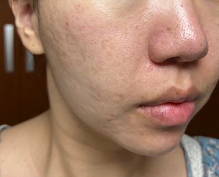 [트리마이] 피부 컨디션에 맞춰쓰는 솔루션 에센스토너 5종 — 5점을 준 리뷰어가 2023년 7월 올린 사용 사진