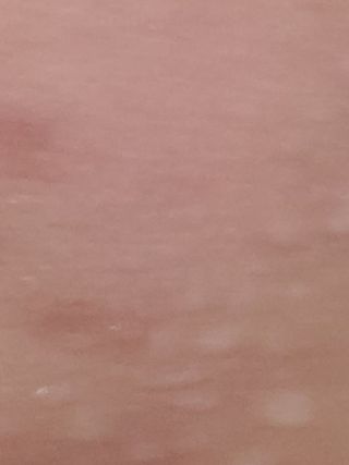 셀바이져 지우개 미스트 피부 보호 입주변 트러블 진정 케어 아기 안개분사 미스트 — 5점을 준 리뷰어가 2021년 2월 올린 사용 사진