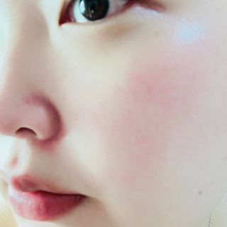 렉스리 닥터 올인원 세럼 Rexri Dr.All-in-one Serum — 5점을 준 리뷰어가 2022년 10월 올린 사용 사진
