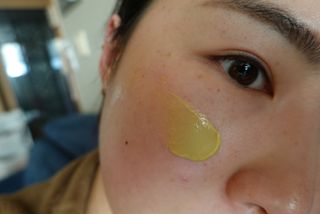 건선/아토/습진/민감성 피부 천연보습진정크림 소리온 크림 & 센시티브 크림 50g — 5점을 준 리뷰어가 2022년 1월 올린 사용 사진