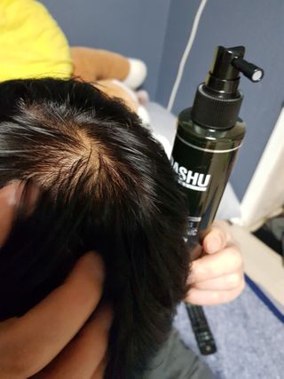다슈코리아 다슈 데일리 안티 헤어로스 허브 헤어토닉 150ml — 5점을 준 리뷰어가 2021년 2월 올린 사용 사진
