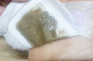 [레제르] 아로마 수액패치 발패치 30매입 -라벤더향/유칼립투스향/대나무향 — 4.5점을 준 리뷰어가 2022년 3월 올린 사용 사진