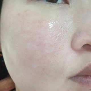 피지오겔 레드수딩 시카밸런스 크림 50ml — 5점을 준 리뷰어가 2022년 4월 올린 사용 사진