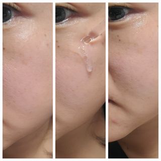 루트리 오디베리 5중 모공 리파이닝 앰플 — 5점을 준 리뷰어가 2023년 8월 올린 사용 사진