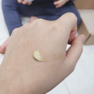 건선/아토/습진/민감성 피부 천연보습진정크림 소리온 크림 & 센시티브 크림 50g — 5점을 준 리뷰어가 2022년 1월 올린 사용 사진