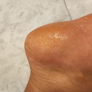짱채맘님이 올린 리뷰 사진 1