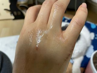 김정문알로에 큐어 큐어 맥시 알로에베라 겔 크림 — 5점을 준 리뷰어가 2021년 2월 올린 사용 사진