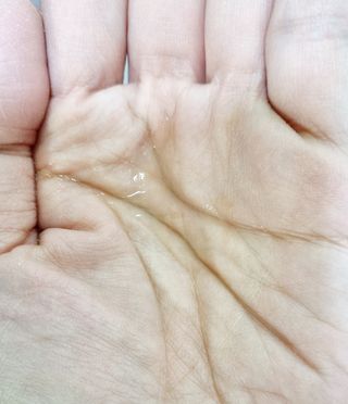 랑팡 EGF+FGF 10ppm 리포좀 앰플 원액 10ml — 5점을 준 리뷰어가 2021년 11월 올린 사용 사진