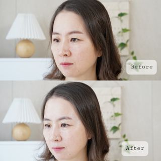 건선/아토/습진/민감성 피부 천연보습진정크림 소리온 크림 & 센시티브 크림 50g — 4.5점을 준 리뷰어가 2022년 1월 올린 사용 사진