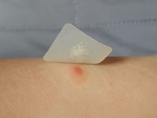 [큐어반H 커팅] 간편하게 떼서 쓰는 자외선차단 습윤밴드 (1팩/30매입) — 5점을 준 리뷰어가 2022년 12월 올린 사용 사진