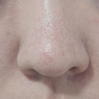 세뚜아(Cettua) 세뚜아 스티키 포어 패치 Cettua Sticky Pore Patch — 5점을 준 리뷰어가 2023년 6월 올린 사용 사진