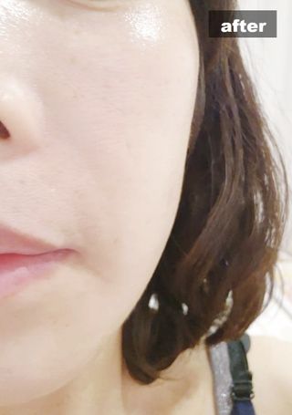 ✅프리 [밀리밀리] 메디 앰플 콜라 15ml — 5점을 준 리뷰어가 2025년 9월 올린 사용 사진
