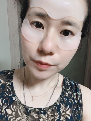 아이디플라코스메틱 아이디 페이스핏 플러스 패치 v2 — 5점을 준 리뷰어가 2021년 5월 올린 사용 사진