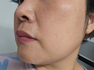 [쿠팡●구매평] 닥터초이스 디판테놀 시카 만능 버블토너 150ml — 5점을 준 리뷰어가 2025년 7월 올린 사용 사진