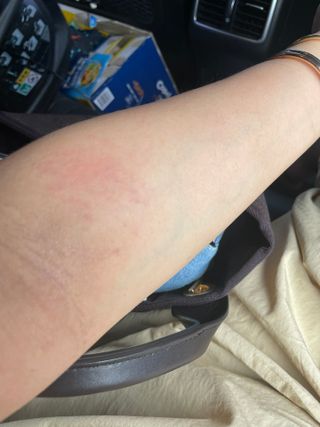 젠바이오 코스메틱스 젠바이오수딩크림]   가려운 피부 & 아토피 원픽 크림 — 5점을 준 리뷰어가 2022년 7월 올린 사용 사진