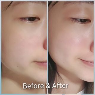 ODEAR ENDERMIC FILL-IN MASK 오데어 엔더믹 필인마스크 — 5점을 준 리뷰어가 2022년 4월 올린 사용 사진