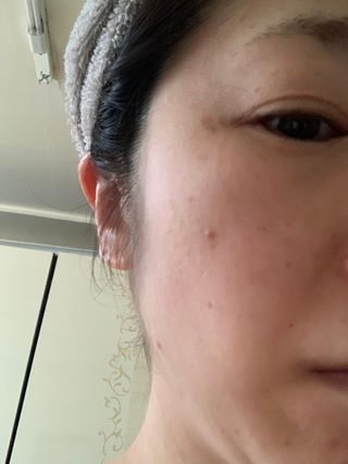 키노닉스 클래리티 밸런싱 크림토너 — 5점을 준 리뷰어가 2022년 2월 올린 사용 사진