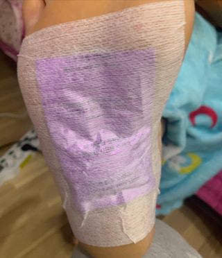 [레제르] 아로마 수액패치 발패치 10매입 유칼립투스 향 — 5점을 준 리뷰어가 2022년 3월 올린 사용 사진