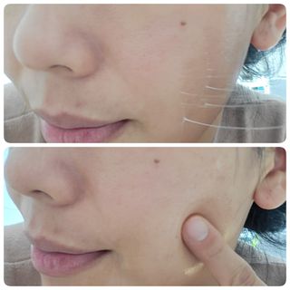 난나 살몬 스파이더 검버섯 미백 톤업 화이트닝 연어 앰플 크림 300ml 대용량 — 5점을 준 리뷰어가 2022년 11월 올린 사용 사진