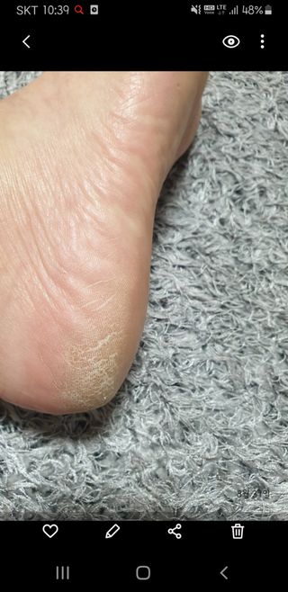 미라클풋 유리발각질제거기 물없이 쓱싹쓱싹 몇번만에 발각질 완벽제거 — 5점을 준 리뷰어가 2021년 9월 올린 사용 사진