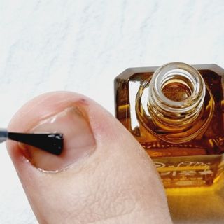 유케어 YOU CARE 문제성 손발톱케어_럭키풋 — 5점을 준 리뷰어가 2022년 10월 올린 사용 사진