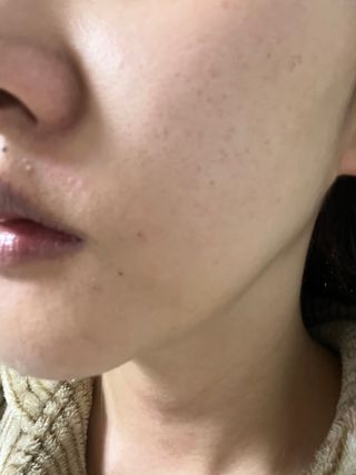선경코스메디 [NCOSTI] 엔코스티 EGF 펩타이드 리페어 마스크팩 10매입 — 5점을 준 리뷰어가 2022년 3월 올린 사용 사진