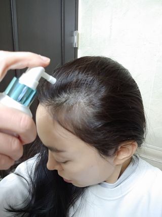 모두발라 탈모집중케어 헤어토닉 — 5점을 준 리뷰어가 2021년 12월 올린 사용 사진