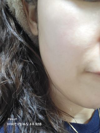 [후르디아] 아보카도 비건 약산성 효소필링젤 — 5점을 준 리뷰어가 2024년 2월 올린 사용 사진