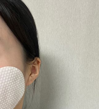 [후르디아] 약산성  모공 필링 패드(70매) — 5점을 준 리뷰어가 2024년 2월 올린 사용 사진