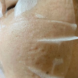 에이스노 레스큐 이미디에이트 수딩 시트마스크 — 5점을 준 리뷰어가 2021년 12월 올린 사용 사진