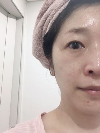 난나 살몬 스파이더 검버섯 미백 톤업 화이트닝 연어 앰플 크림 300ml 대용량 — 5점을 준 리뷰어가 2022년 8월 올린 사용 사진