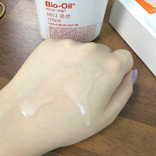바이오오일 [바이오-오일] 바디 로션 175ml — 5점을 준 리뷰어가 2021년 9월 올린 사용 사진