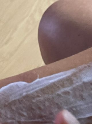 젠바이오 코스메틱스 젠바이오수딩크림]   가려운 피부 & 아토피 원픽 크림 — 4.5점을 준 리뷰어가 2022년 8월 올린 사용 사진