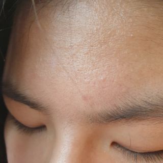 세뚜아(Cettua) 세뚜아 스팟 클리어 듀얼 패치 Cettua Spot Clear Dual Patch — 5점을 준 리뷰어가 2023년 9월 올린 사용 사진