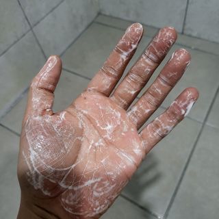 빅그린 카렌듈라(지성두피용)&시카(중건성두피용)탈모샴푸500ml-택1,빅그린 프리미어바이옴탈모앰플팩 60ml — 3점을 준 리뷰어가 2023년 1월 올린 사용 사진