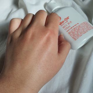바이오오일 [바이오-오일] 바디 로션 175ml — 5점을 준 리뷰어가 2021년 11월 올린 사용 사진