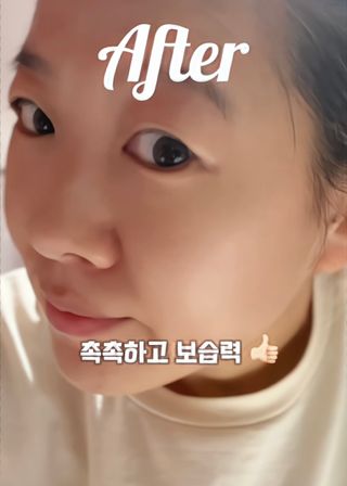 틱톡 캠페인 ★ ｜ Tiktok x 0.8L 에스트라리제덤 2차 크림 (최종) — 5점을 준 리뷰어가 2024년 12월 올린 사용 사진