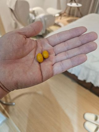 아이비웰니스 롱비다 커큐민 강황 400mg 함유 아이비 옐로우 초임계 알티지 오메가3 KD 파마 (30캡슐) — 5점을 준 리뷰어가 2024년 11월 올린 사용 사진