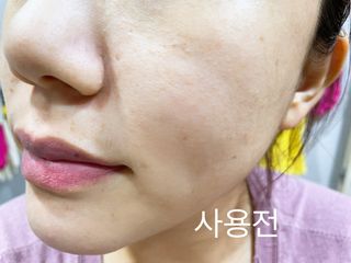 [후르디아] 약산성  모공 필링 패드(70매) — 5점을 준 리뷰어가 2021년 7월 올린 사용 사진