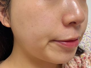 더메디코템 일루미네이팅 오로라 에멀젼마스크 — 3점을 준 리뷰어가 2025년 6월 올린 사용 사진